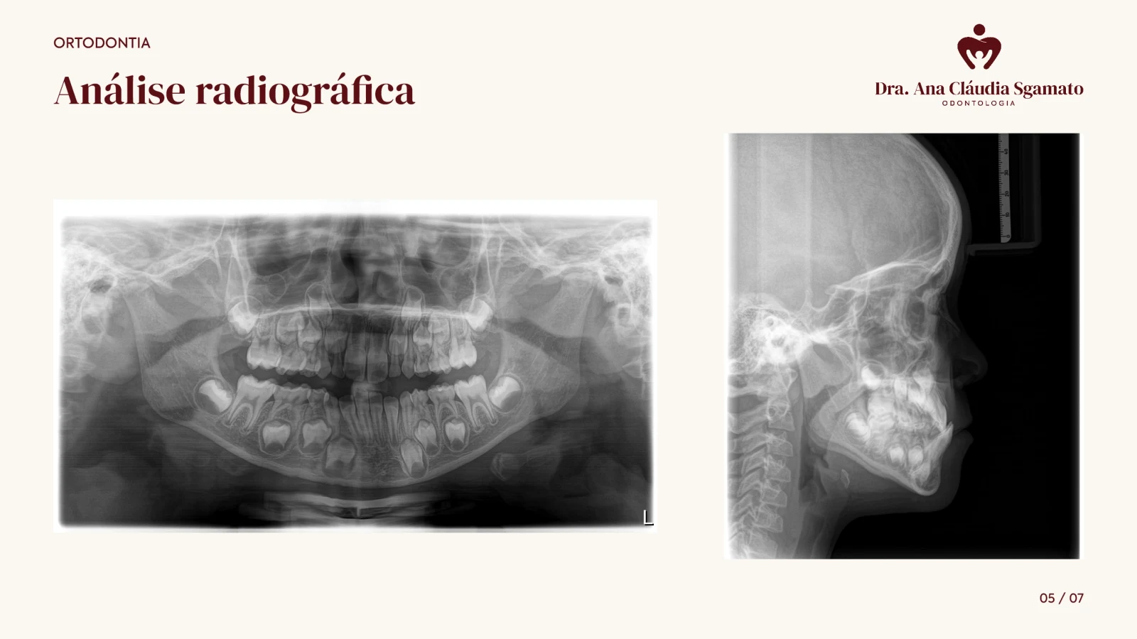 Recorte da apresentação da clínica com registros radiográficos panorâmico e lateral